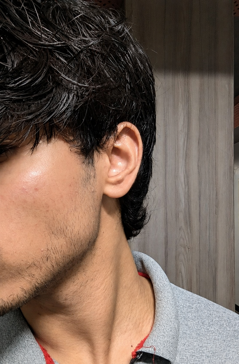 Neck and jawline