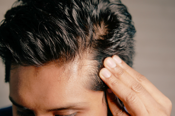 Supports Healthy Hair Density